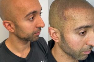Beard Booster